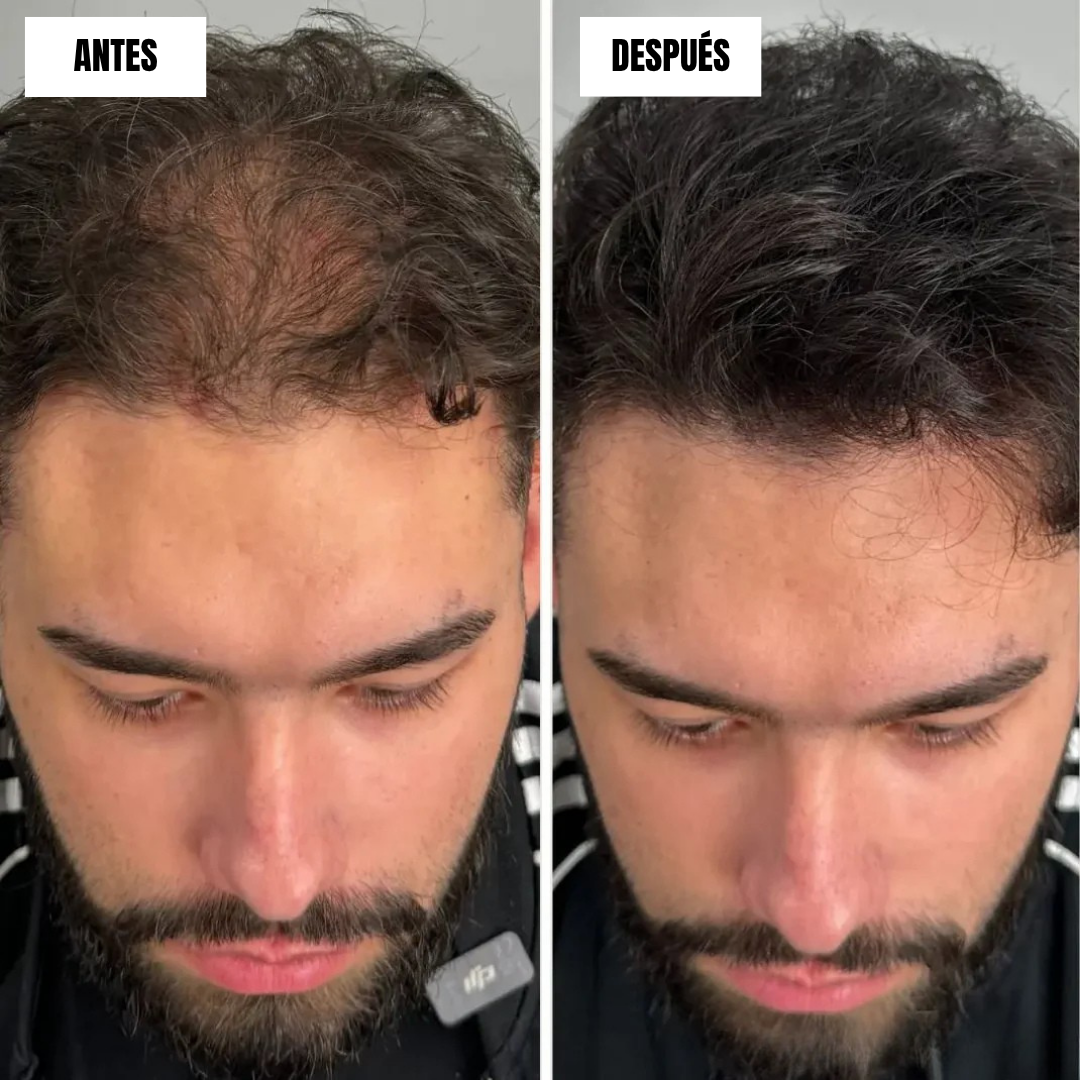 Crema Capilar con Efecto Volumen Instantáneo (OFERTA 2X1)®