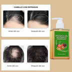 Shampoo Nutritivo Con Aceite De Batana Y Romero 300 Ml