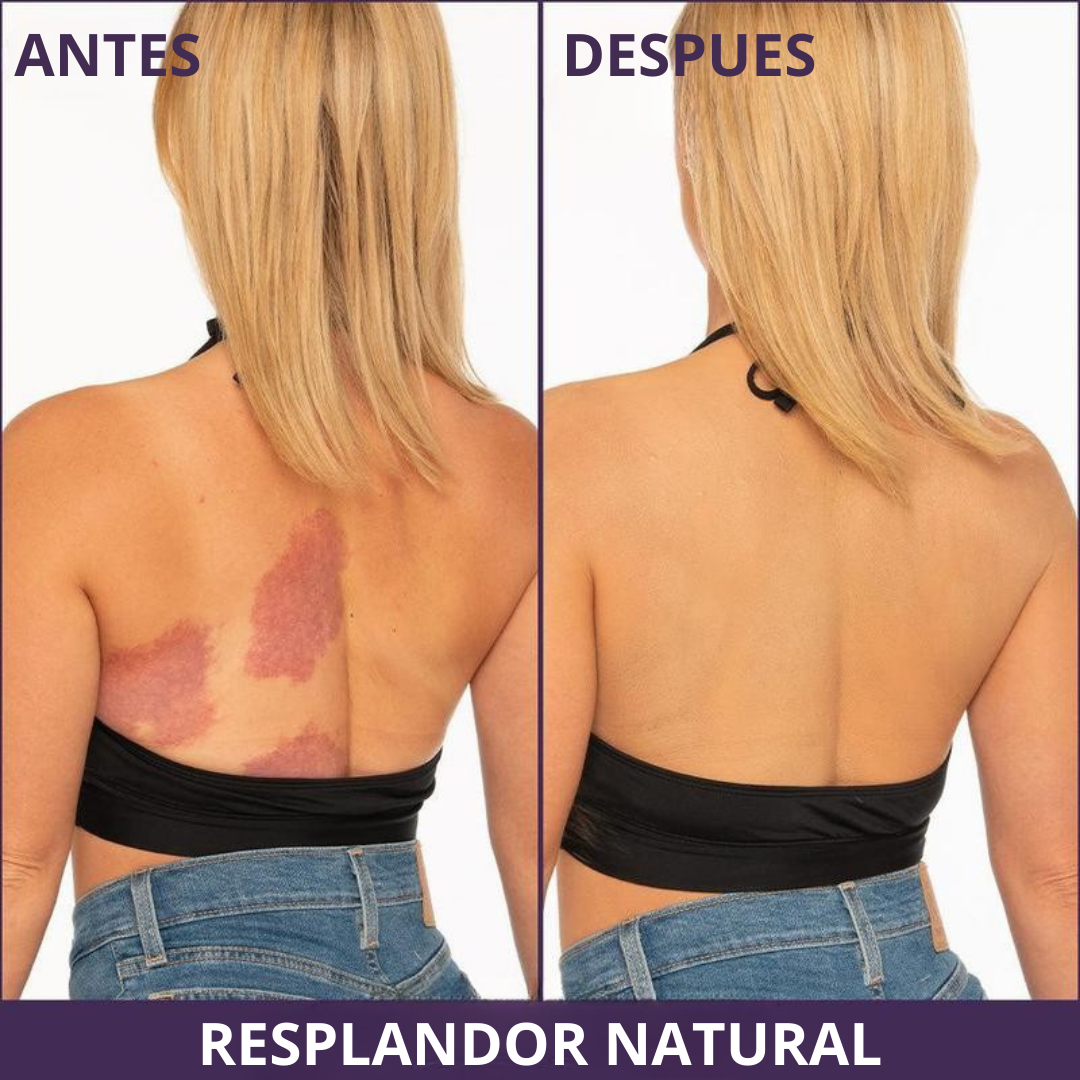 Maquillaje Corporal de Alta Cobertura para Piernas y Cuerpo (OFERTA 2X1)®