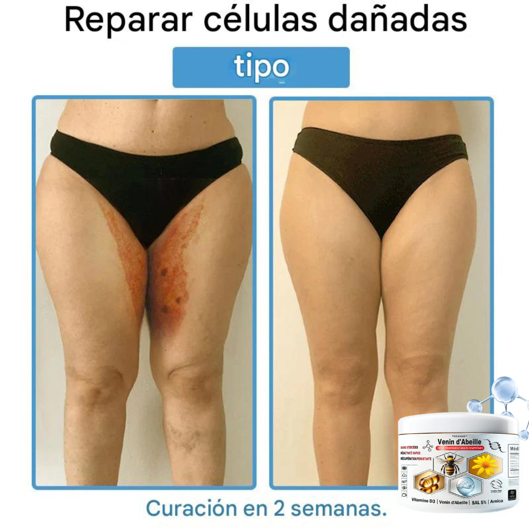Crema antiinflamatoria multisíntomas con veneno de abeja (OFERTA 2X1)®
