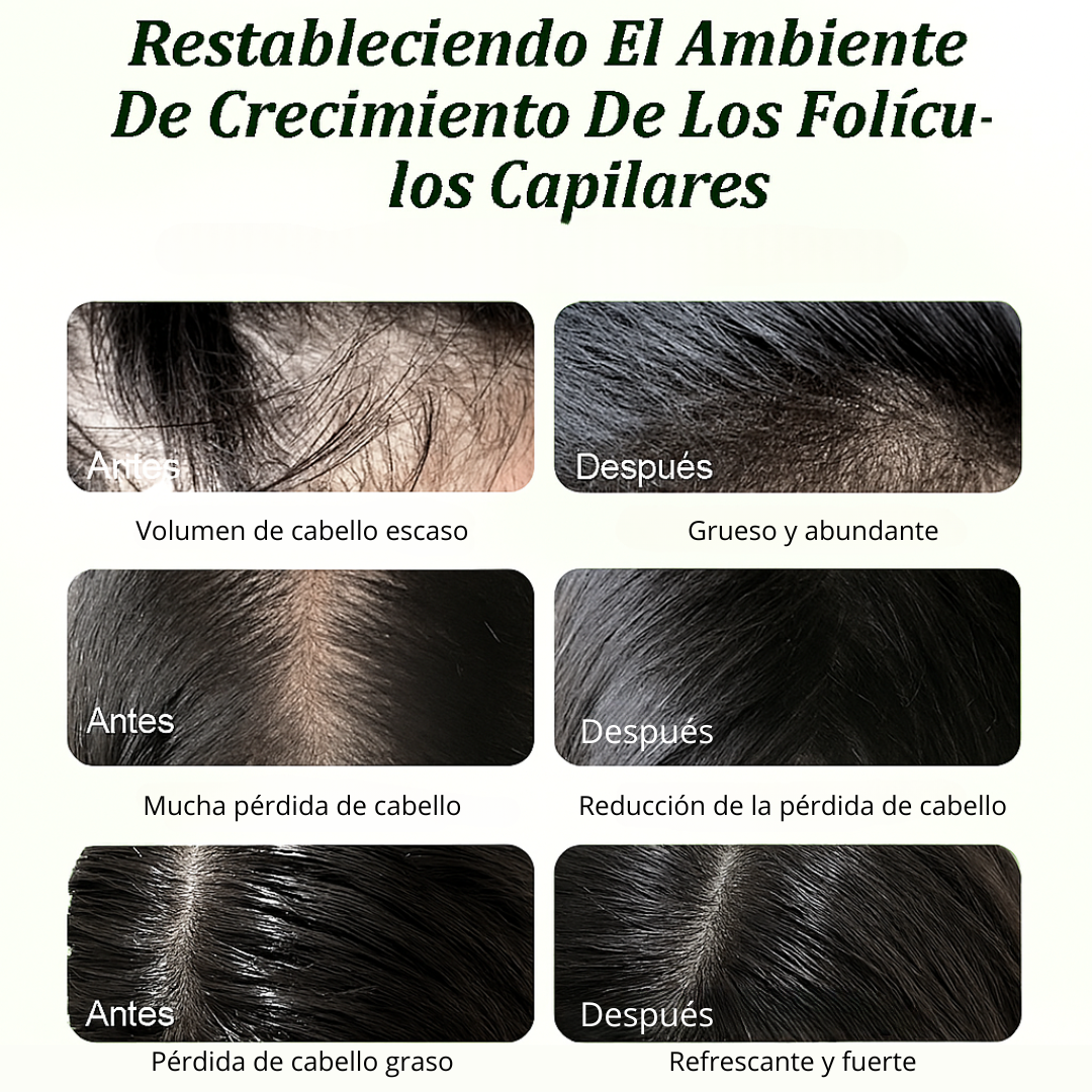 Shampoo Nutritivo Con Aceite De Batana Y Romero 300 Ml