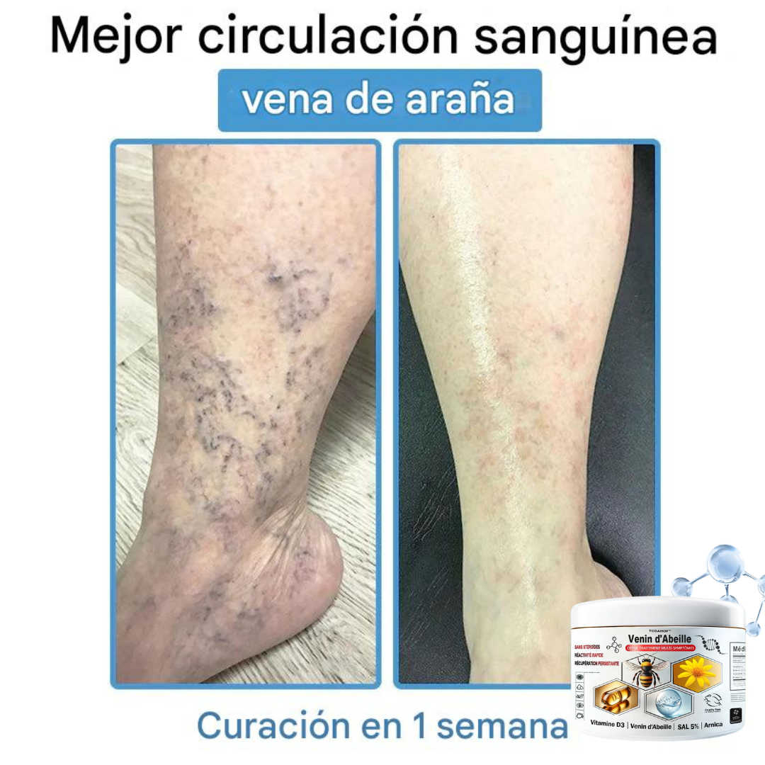 Crema antiinflamatoria multisíntomas con veneno de abeja (OFERTA 2X1)®